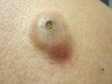 external_image external_image