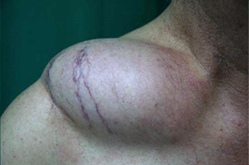 external_image external_image