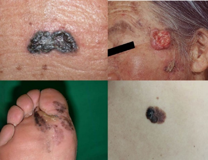 external_image external_image