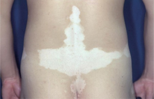 external_image external_image