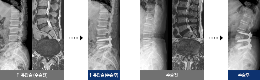 후